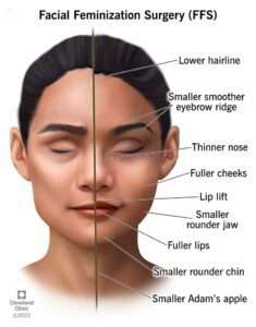 Modern Technology Changing Facial Reconstruction Recovery