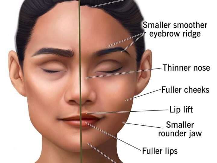 Modern Technology Changing Facial Reconstruction Recovery
