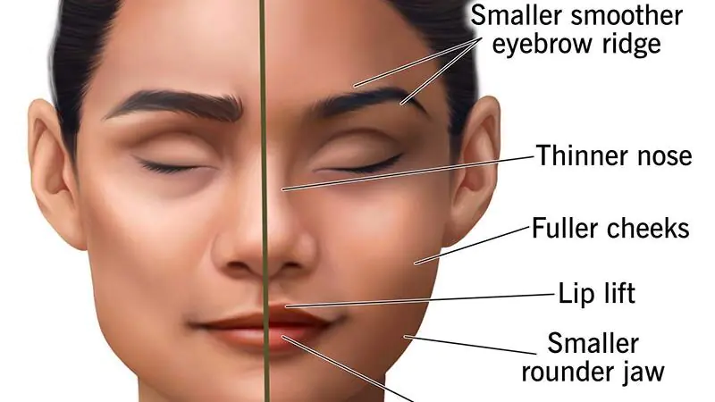 Modern Technology Changing Facial Reconstruction Recovery 5 Modern Technology Changing Facial Reconstruction Recovery